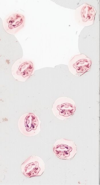 Media type: image; Special Collections 3992   shows specimen_part histological serial section;